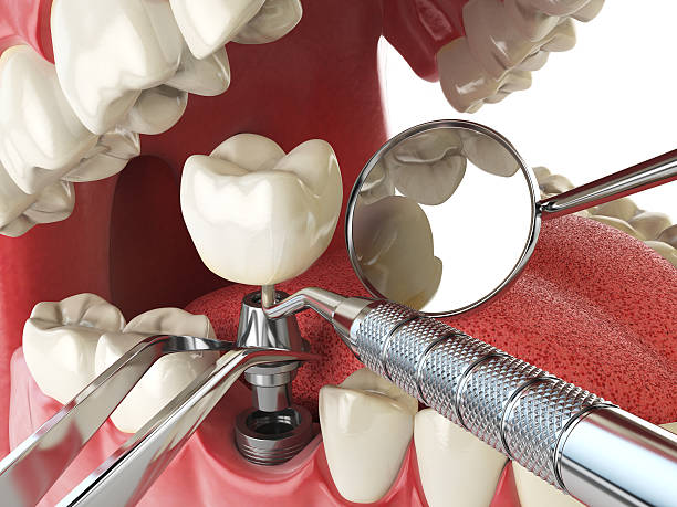 Best Urgent Tooth Repair  in Cold Spring, NY